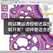 网站建站选模板还是定制开发？哪种更适合自己？